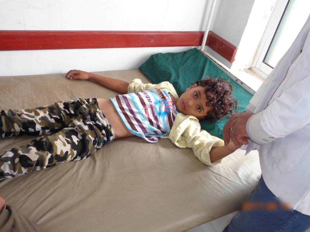 Dünya Sağlık Teşkilatı: 'Yemende Koleradan 1146 Kişi Öldü'